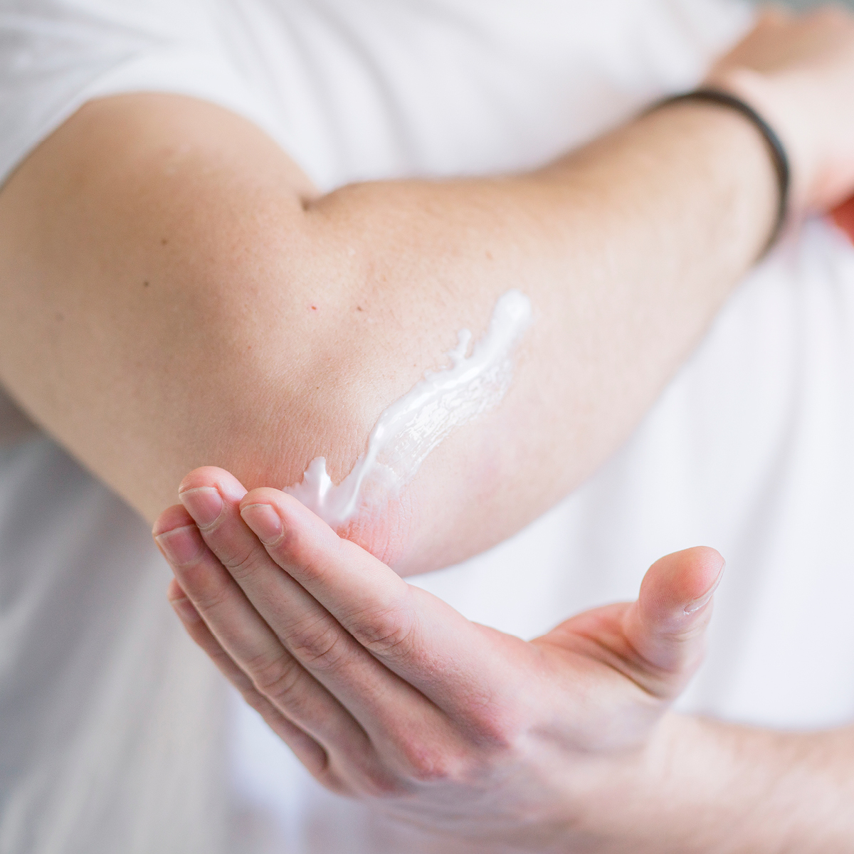 Mann trägt Spezialpflege auf seinem Ellenbogen auf