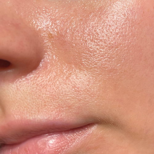 Nahaufnahme großer Poren