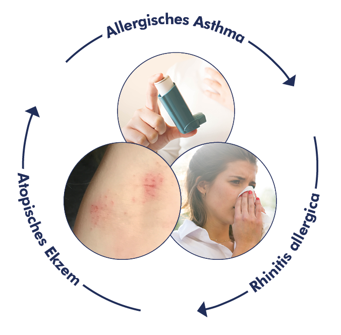 Atopischer Formenkreis