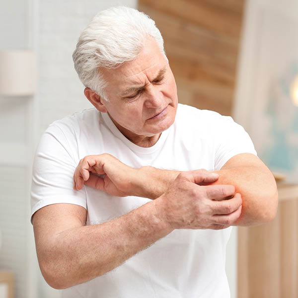 Juckreiz betrifft viele ältere Menschen Älterer Mann kratzt sich am Ellenbogen