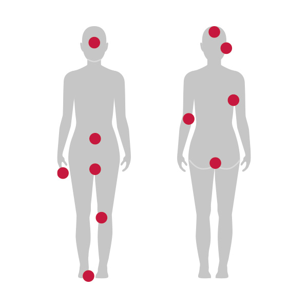 Silhouette eines Menschen, bei typische Körperbereiche rot markiert sind.