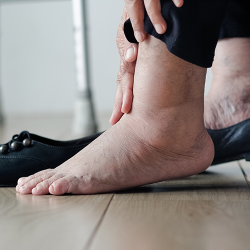 rissiger Fuß einer älteren Person