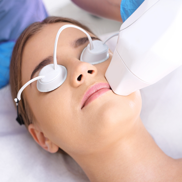 Lasertherapie bei Teleangiektasien