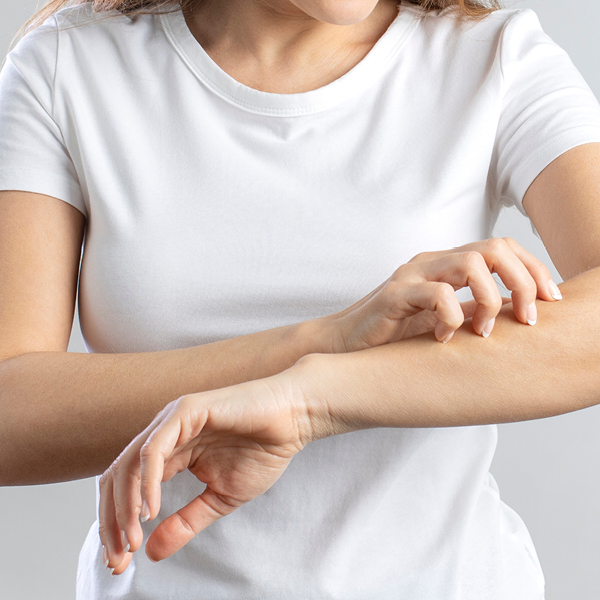 Eine Frau kratzt sich am Unterarm.