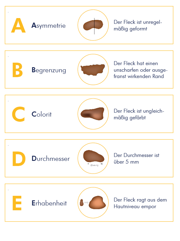 Grafik der ABCDE-Regel