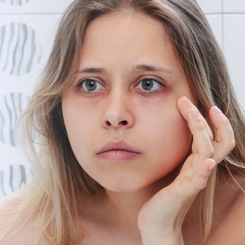 Frau mit trockener Haut berührt ihr Gesicht