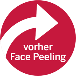 vorher Face Peeling