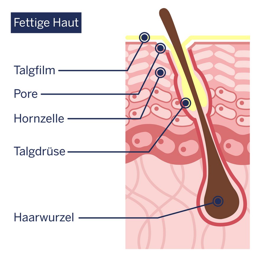 Schematische Darstellung: Aufbau der fettigen Haut