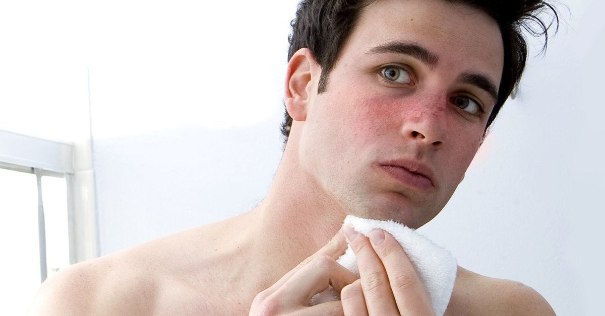 Rosacea an der Nase Wissenswertes zum Rhinophym