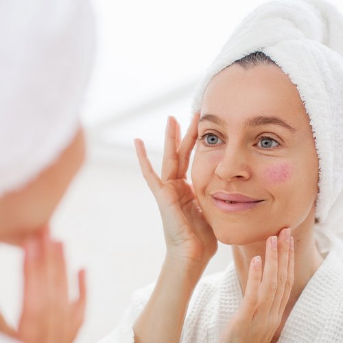 Frau betrachtet im Spiegel ihre Teleangiektasien im Gesicht