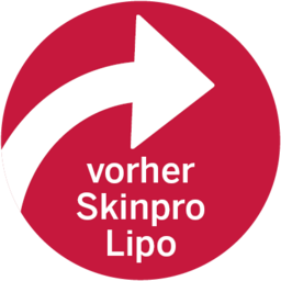 vorher SkinPro Lipo
