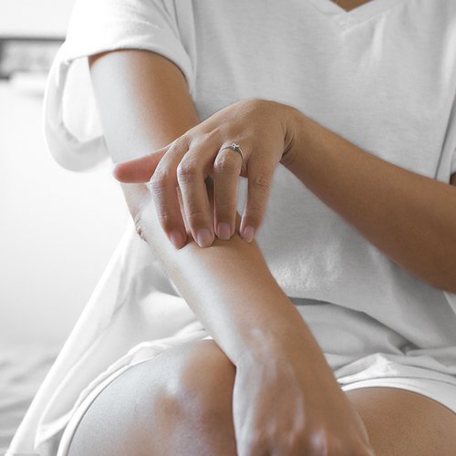 Frau kratzt ihre Armbeuge