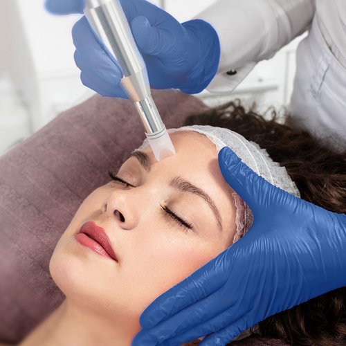 Frau erhält apparative Kosmetikbehandlung (Mikrodermabrasion)