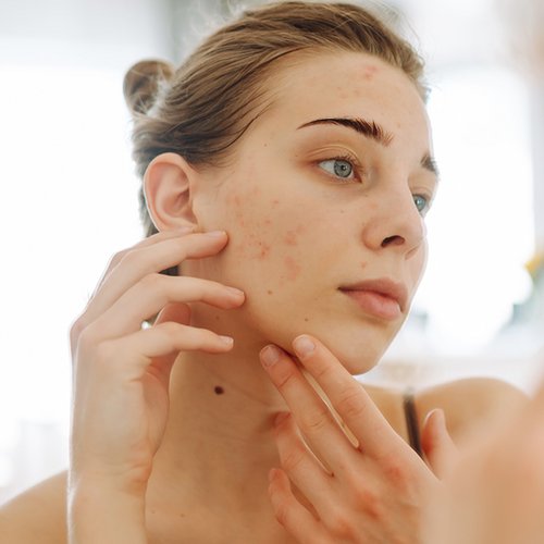 Junge Frau untersucht ihre Haut im Spiegel.