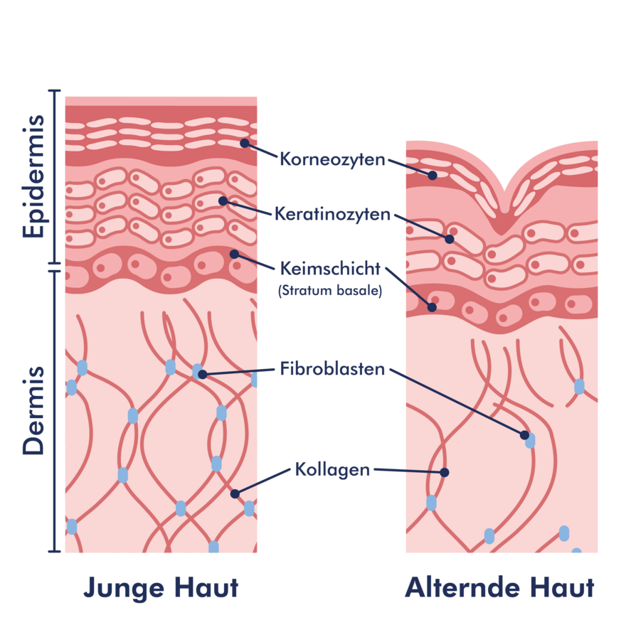 Grafik der Hautalterung bzw. Faltenbildung