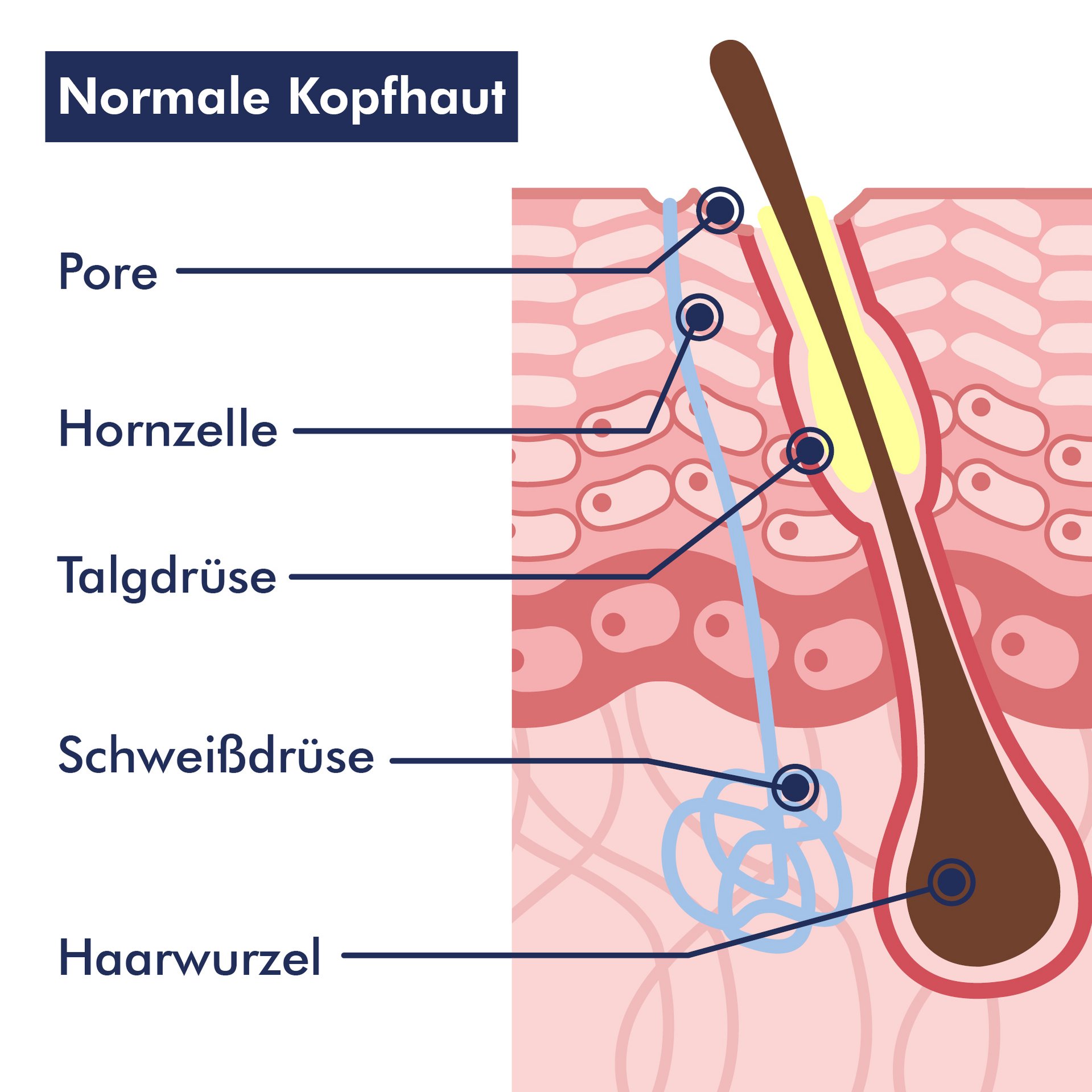 Eine gesunde Kopfhaut ist frei von übermäßigen Schuppen und Juckreiz Grafik einer gesunden Kopfhaut