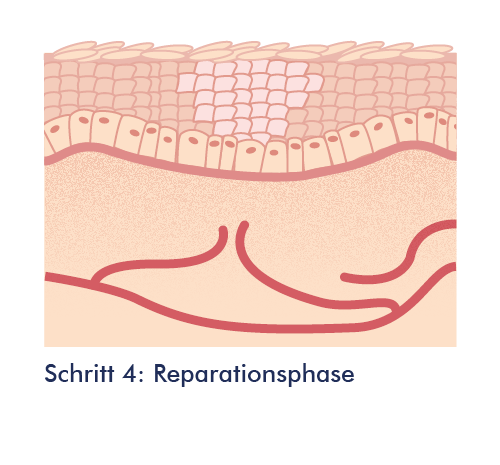 Grafik: Schritt 4 – Die Reparationsphase