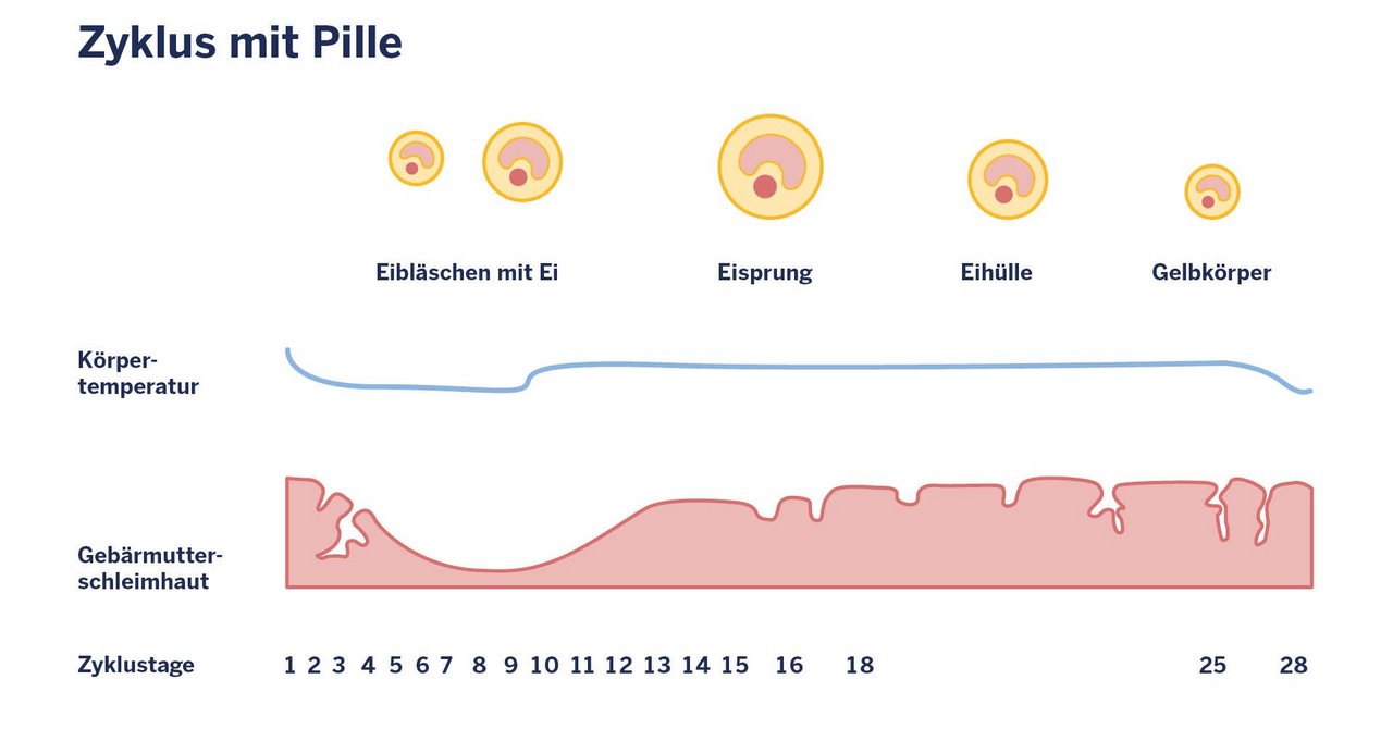 Hormonelle Akne und der weibliche Zyklus